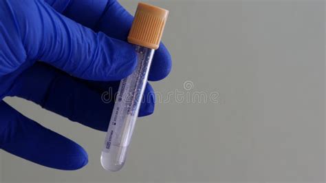 Blood Collection Container Hand In Blue Nitrile Glove Empty Blood