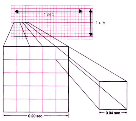 EKG Paper - EKG Lesson #301