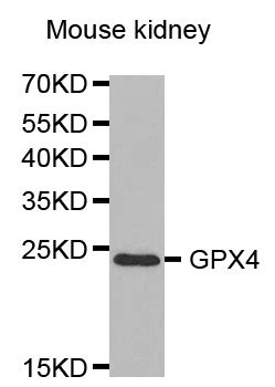 Rabbit Anti Gpx Polyclonal Antibody Absin