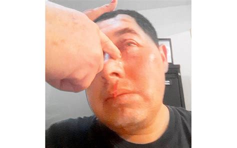 Golpean A Hijo De Comerciante El Sol De Hidalgo Noticias Locales