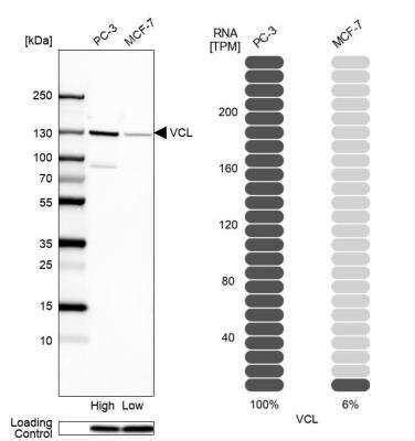 Vinculin Antibody (NBP2-55796): Novus Biologicals