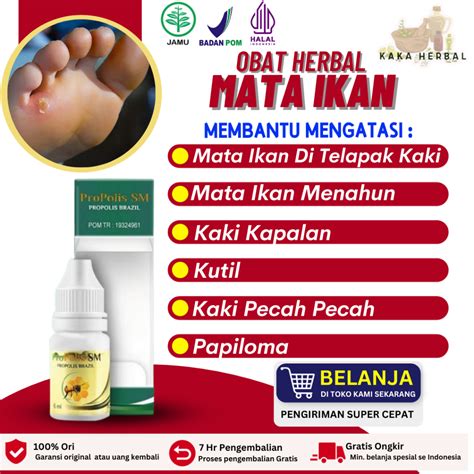 Jual Kaka Herbal Obat Mata Ikan Di Telapak Kaki Obat Tetes Mata Ikan