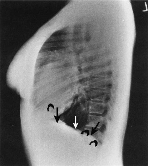 Chest Radiology Key