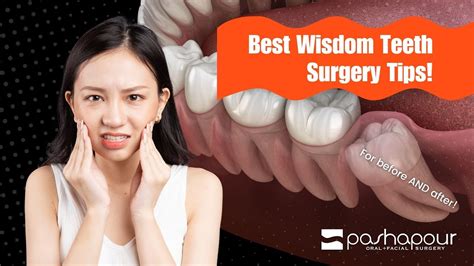 The Ultimate Guide What To Do Before And After Your Wisdom Teeth Surgery Youtube