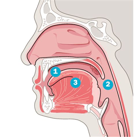 HPV Auf Der Zunge