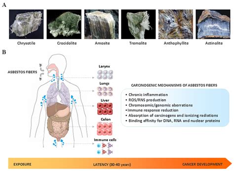 Cells Free Full Text Asbestos And Intrahepatic Cholangiocarcinoma