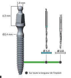 Alpha Bio Tec Arb Arrow Ball Implants Implante Dental Spotimplant