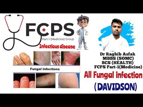 Learn All Fungal Infection In 10 Minutes Infectious Disease By Dr