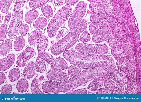 Section Of Testis Tissue Under The Microscope Stock Photo Image Of