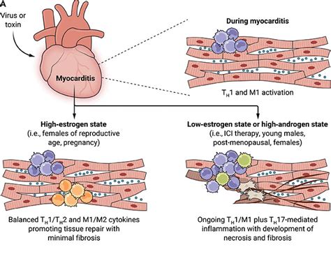 Sex Differences In Ici Myocarditis Hormones To The Rescue Science