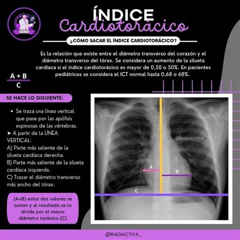 Pin De Adelaida En Medicina Estudiante De Radiolog A Anatom A