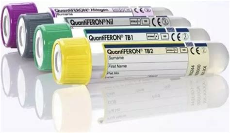 Tb Testing The Differences Between Quantiferon Gold Quantiferon Gold