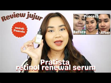 Review Jujur Pratista Retinol Renewal Serum Untuk Pemula Youtube