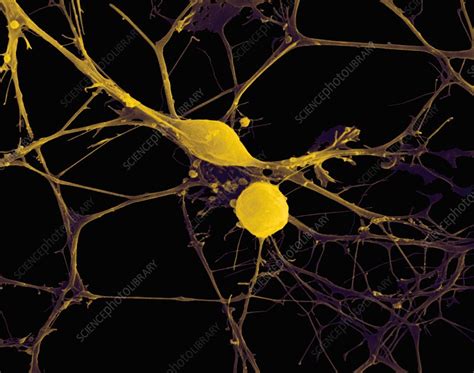 Neurons From The Cns Sem Stock Image C Science Photo Library