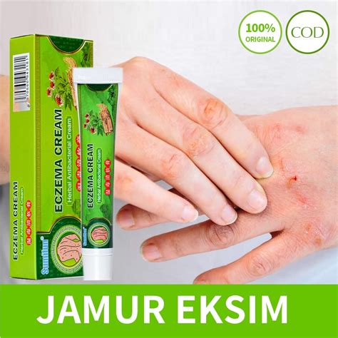 Jual Salep Psoriasis Krim Salep Gatal Salep Eksim Salep Kulit G Krim