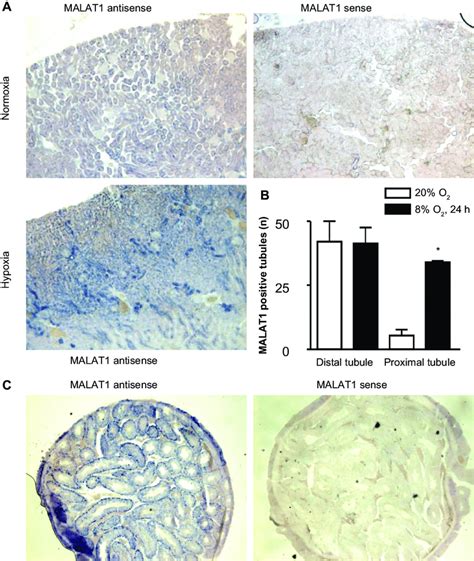 In Situ Expression Of The Lncrna MalaT1 In Vivo Mice Were Exposed To