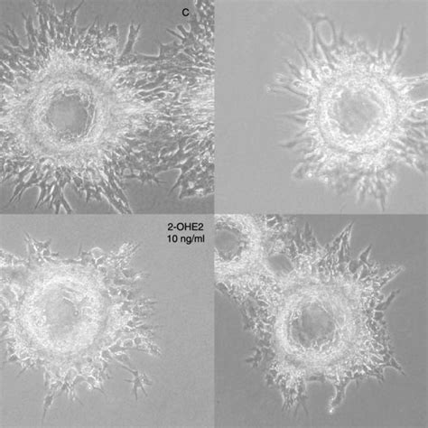 Phase Contrast Micrographs Showing Aoc Growth At 96 H In Fibrin Gel