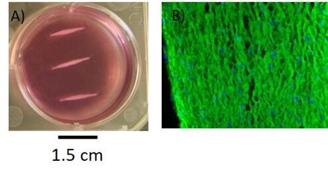 Outlook For Stem Cell Therapy Its Role In Tendon Regeneration