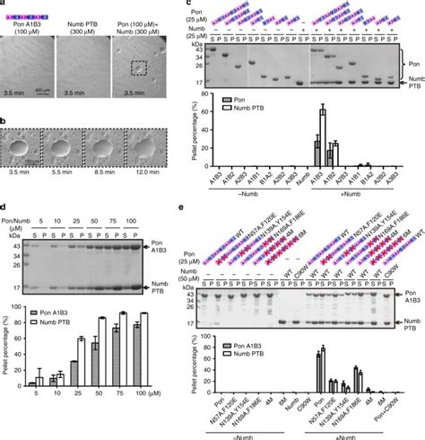 Basal Condensation Of Numb And Pon Complex Via Phase Transition During Drosophila Neuroblast