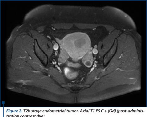 Figure 2 From Cardiovascular And Metabolic Pathologies Associated With