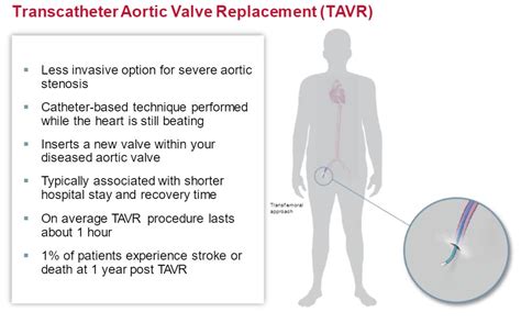 Transcatheter Aortic Valve Replacement Tavr Columbus Regional Health