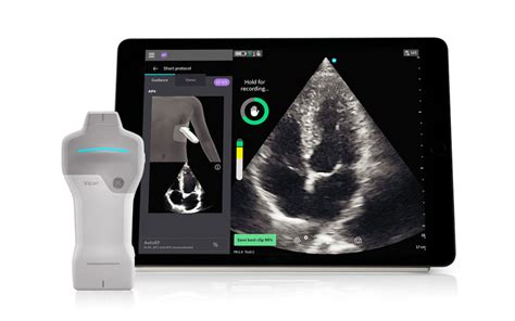 Ge Healthcare Introduces Caption Ai On Vscan Air Sl Wireless Handheld