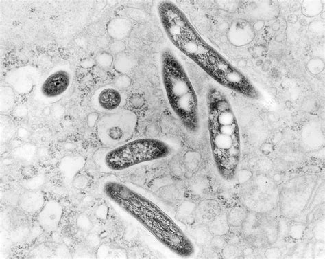 Mycobacterium avium lung infection, TEM - Stock Image - C036/7431 ...