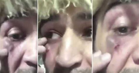 Así quedó el rostro del primo de Khabib tras agarrarse a golpes con