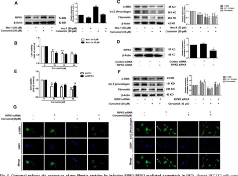 Figure 1 From Curcumol Induces RIPK1 RIPK3 Complex Dependent