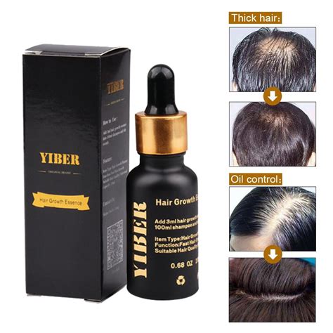 20 ML Hair Growth Essence Oil Hair & Scalp Treatment Hair Loss Products ...