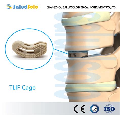 Transforaminal Lumbar Intervertebral Fusion Tlif Cage System Peek