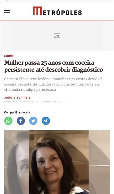 Como Ficar Livre Das Manchas Escuras Nas Costas Provocada Pela Notalgi