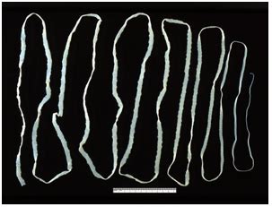 Tapeworms in Humans: Symptoms & Treatment | Study.com