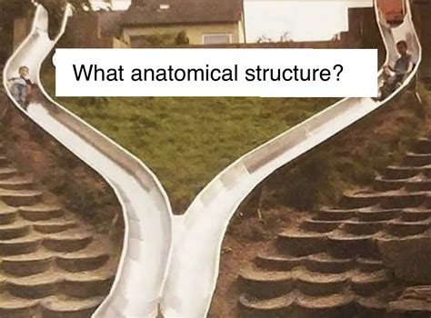 Oren Gottfried Md On Twitter What Anatomical Structure Do You See