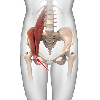 Iliopsoas Tendonitis Waxahachie | Snapping Hip Syndrome Midlothian, Red Oak