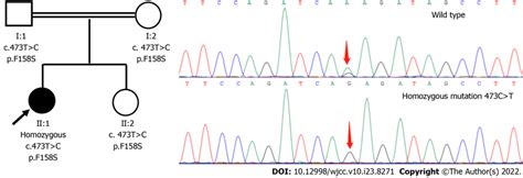 Pedigree And Sanger Sequencing Validation Of Homozygous Mutation