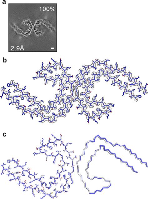 Phf Tau Filaments From Case Aβpparc1 A Cross Sections Of Tau Filaments