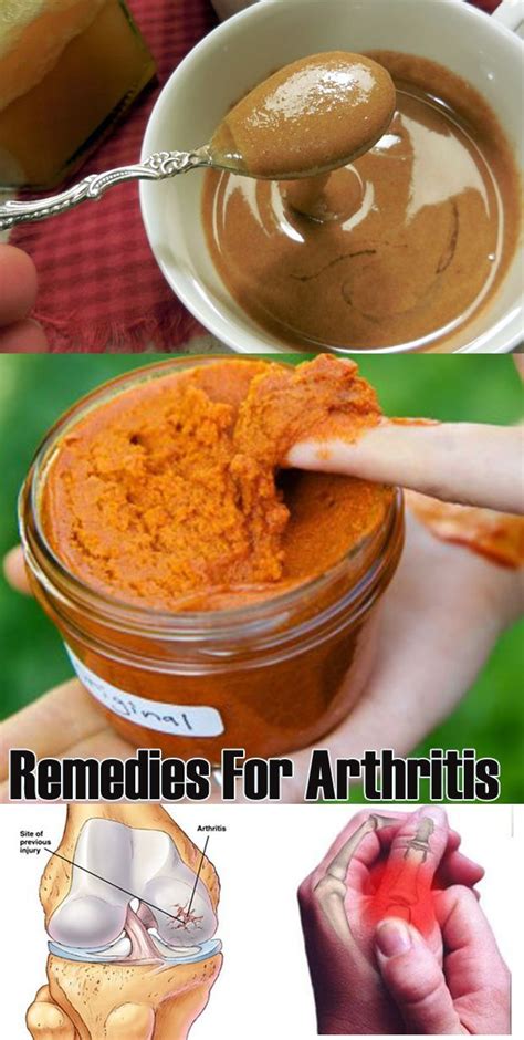 10 Best Home Remedies For Arthritis Natural Cure For Arthritis