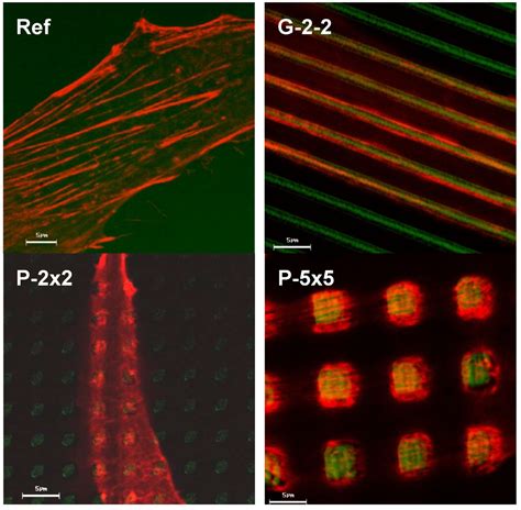 Automatic Actin Filament Quantification Of Osteoblasts And Their