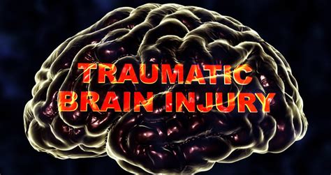 Tbi Brain Injury Lawyer Marc J Shuman And Associates Ltd