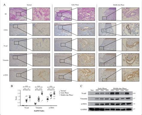 Pdf Yap Induced Endothelial Mesenchymal Transition In Oral Submucous