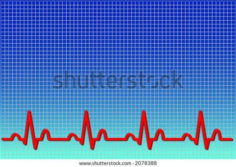 Vector format of an ecg ekg. The waveform is accurate and represents a real life normal ekg