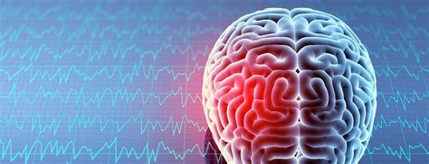 Traumatic Brain Injury | Johns Hopkins Medicine