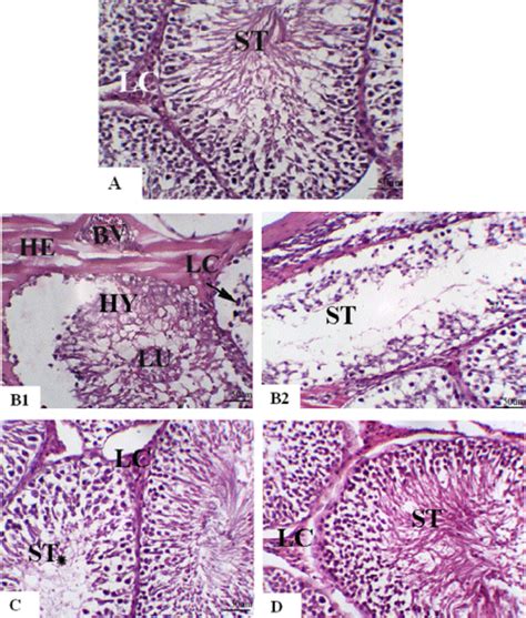 A Photomicrograph Of Testis Staining With H And E X 200 Scale