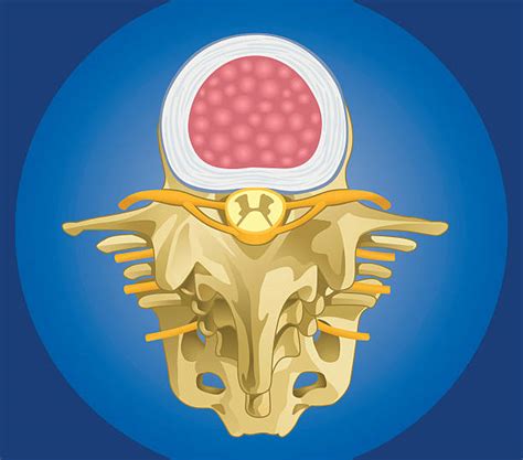 Intervertebral Joints Stock Photos Pictures And Royalty Free Images Istock