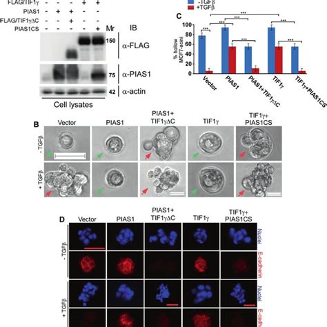 PIAS1 and TIF1γ act reciprocally to suppress EMT in luminal breast