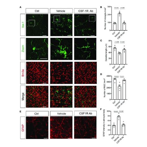 Targeting Microglia By CSF 1RAb Attenuated Morphological Changes Of