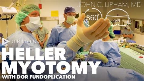 Heller Myotomy with Dor Fundoplication - Dr. John Lipham - saying about ...