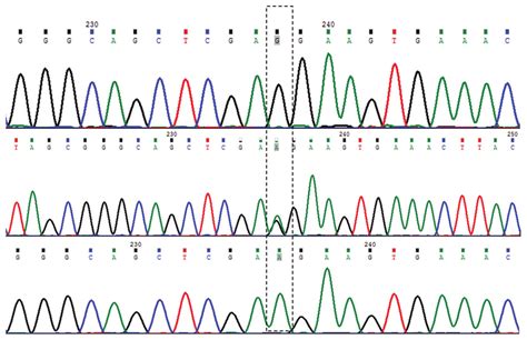 Dna Sequence Chromatogram Showing Nucleotide Sequence Variation In Download Scientific Diagram