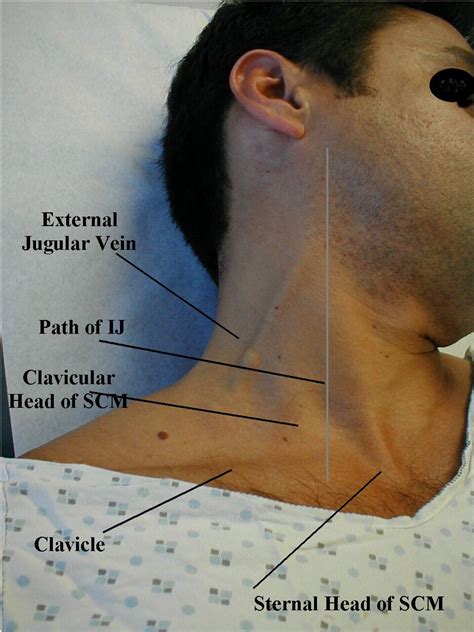 The Jugular Venous Pulse And Hepatojugular Reflux Examinations Of